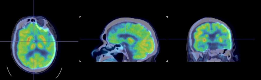 Case 5 Patient moves between CT and PET Original images