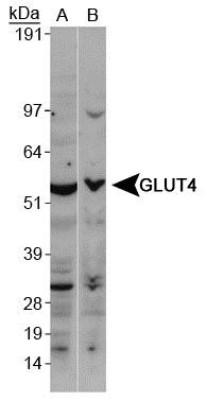 1 Updated 2/20/2019 Immunohistochemistry: Glut4 Antibody [NBP1-49533] - Analysis of GLUT4 in mouse kidney Flow (Intracellular): Glut4 Antibody [NBP1-49533] - An intracellular stain was performed on