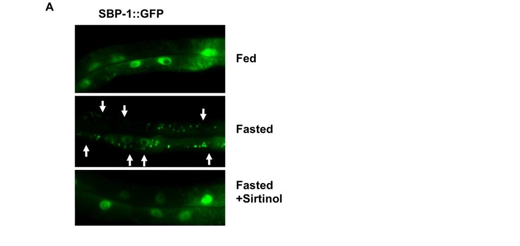 Walker et al._supplemental Figure 4 Supplemental Figure 4. SIR-2.1 is essential for proper fasting-dependent down-regulation of SBP-1::GFP C. elegans.