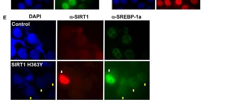 At 42 hours, cells were treated with proteasome inhibitors, and were harvested at 48 hours, stained with antibodies to SREBP-1a along with DAPI and visualized by immunofluorescence.