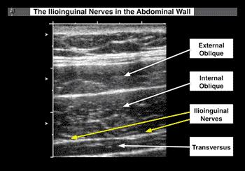 trace the 3 layers of abdominal wall