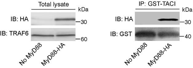 Figure 4. TACI interacts with MyD88. Left gels: Immunoblotting (IB) of HA or TRAF6 (loading control) from lysates of 293 cells expressing or not HA-MyD88.