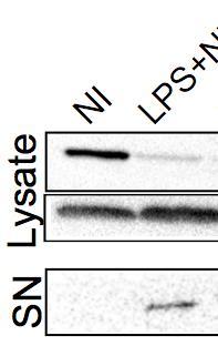 Caspase-1 KO BMDMs are resistant to ExlA ExlA + Wild-type BMDMs Caspase-1 activation IL-1ß maturation