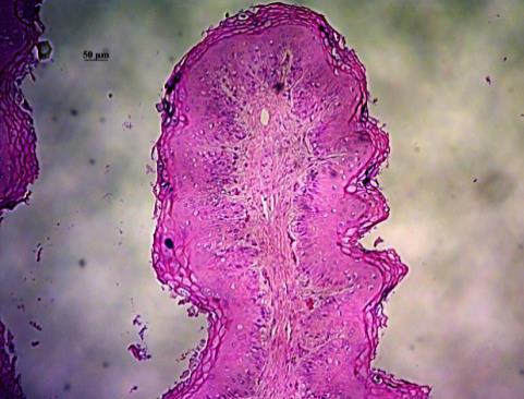 Results: Papillae histomorphometry ventral blind Papillae width Papillae area