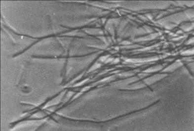 with methane emissions Protozoa (10 4-10 6 cells/ml) Ciliate species digesting suspended and colonized