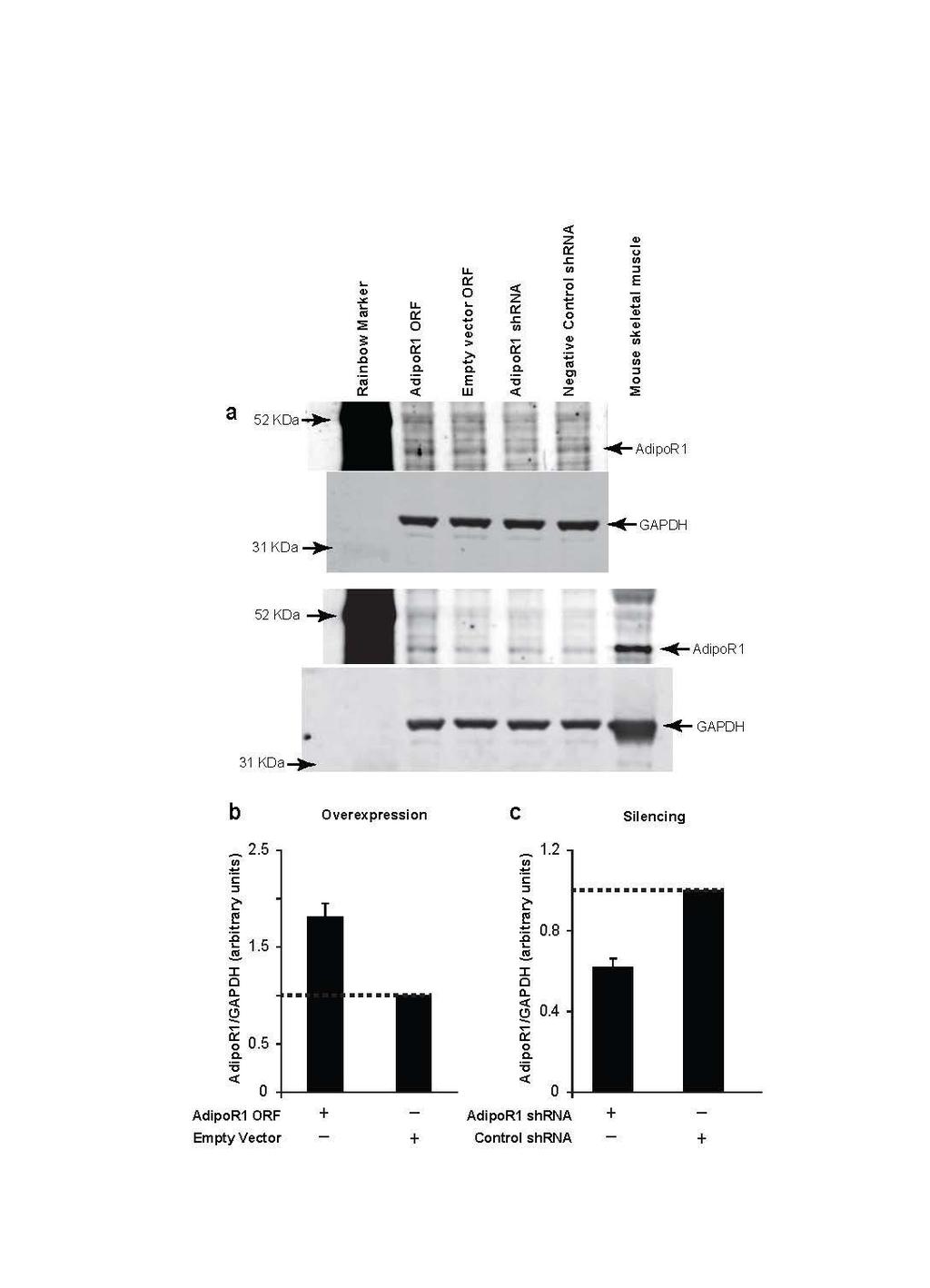 Supplementary Figure 1. AdipoR1 silencing and overexpression controls.