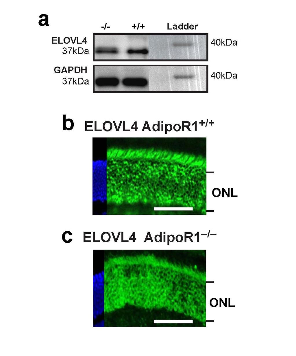 Supplementary Figure 2. ELOVL4 is not down-regulated in AdipoR1 -/- retinas. (a) Western blot demonstrating no significant difference in ELOVL4 concentration between AdipoR1 +/+ and -/- retinas.