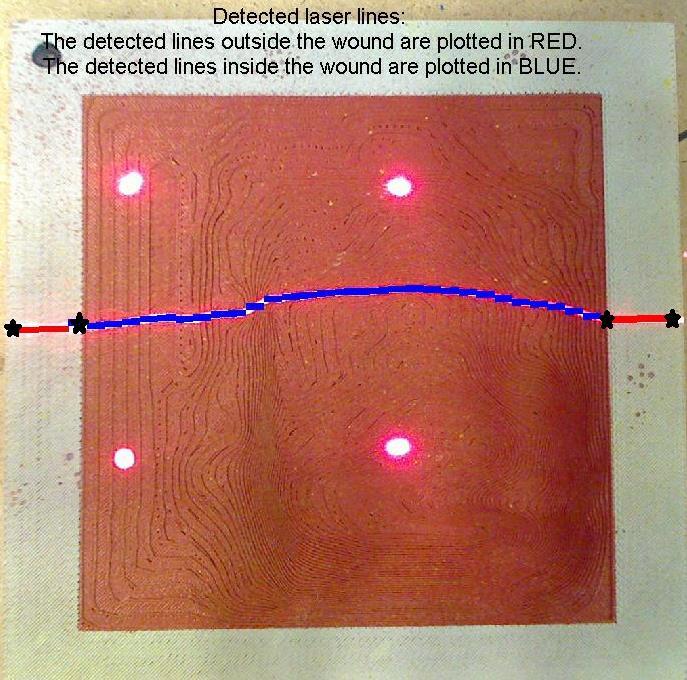 Wound Depth Measurement Let a user click four points on the projected laser line Two outside the wound Two on the edge of the wound Detect the laser line outside the wound, and segments of laser line