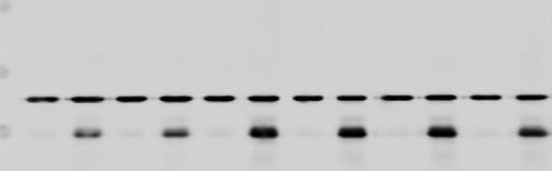Figure 2b 1 nm 1 mm ERAP 5 Nucleus of ERa - - + + - - + +