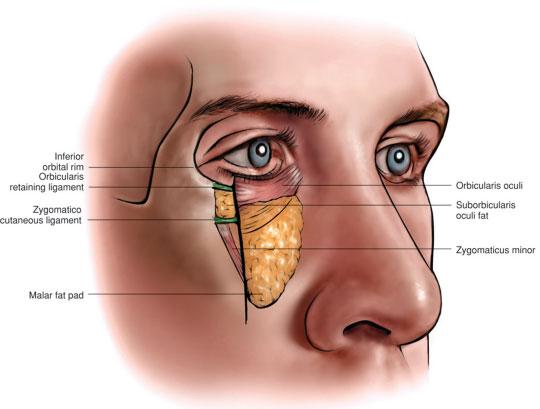 42 Understanding Midfacial Rejuvenation in the 21st Century Chaiet, Williams Fig. 2 Cross-sectional diagram of midface anatomy.