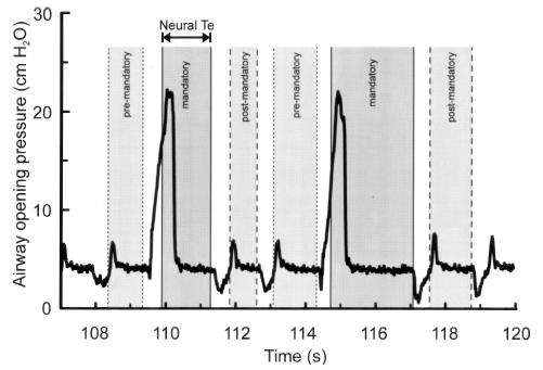 expiratory asynchrony Online monitoring of diaphragm activation during IMV Beck, J., et al., Pediatr Res, 4. 55(5): p. 747-754.