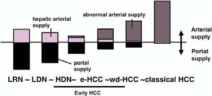 arterial enhancement without washout Natural history of HCC development Pre