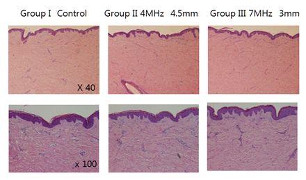 (Day 1), and same as Day 0, no skin surface damage or adverse reaction in dermis was found. (Figure 5B).