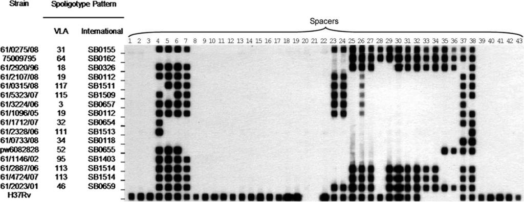 2554 SMITH ET AL. J. CLIN. MICROBIOL. FIG. 1. Sample of M. microti spoligotype patterns identified between 1994 and October 2008.