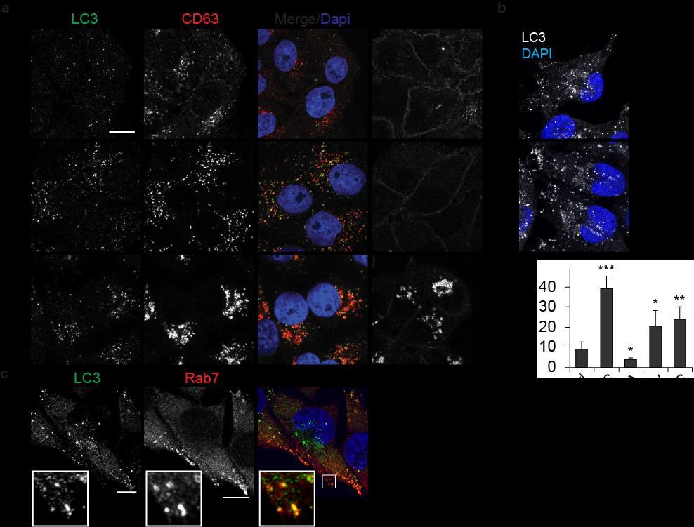 Supplementary Information Supplementary Figure 1: cholesterol manipulation alters the positioning of autophagosomes in cells, related to figure 1.