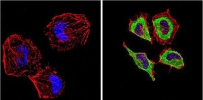 Images Western Blot: Endothelin-1 Antibody (TR.ET.48.