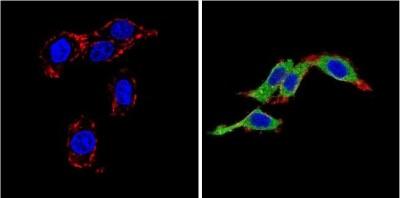 Immunocytochemistry/Immunofluorescence: Endothelin-1 Antibody (TR.ET.48.