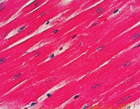 Fig. 3 normal heart muscle Fig.