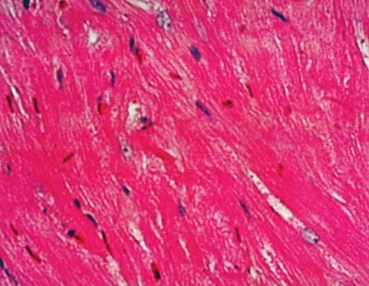 small arteries. The pathology study was initiated to examine the hearts of normal Salukis however, some dogs did develop heart-related signs.
