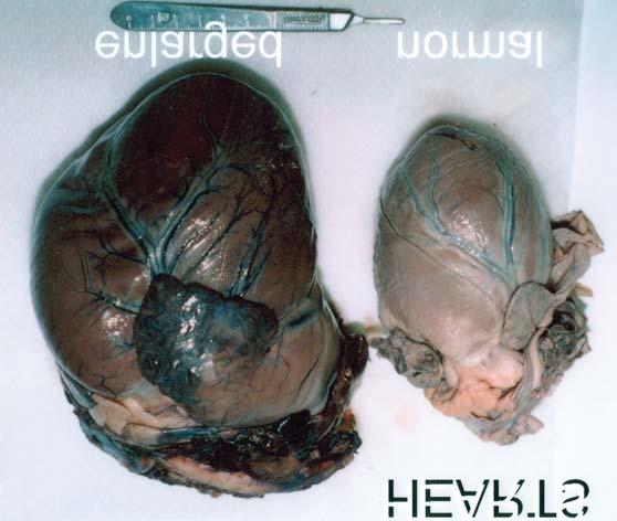 myocarditis or an infection affecting the heart, and two from congenital valvular heart defects. Fig.