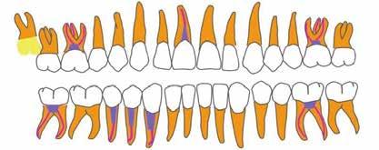 Definite treatment plan Patient's expectation 1. 2. 3. 4. Esthetic goal 1. Bright and white tooth shade 2. Convex incisal curvature 3.