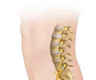 The disk s soft center can begin to bulge. A bulging disk may pinch a nerve.