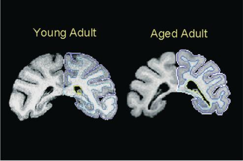 The Primal Teen as the teenage brain is reconfigured, it remains more exposed, more easily wounded, perhaps much more susceptible to critical and long-lasting damage than most parents and educators