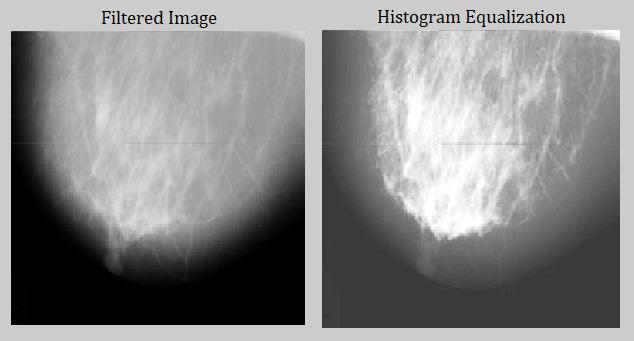 2. Histogram Equalization The essential step in detecting the cancer region in the mammogram is the histogram equalization, where the relative frequency of the pixels in a given image is shown.