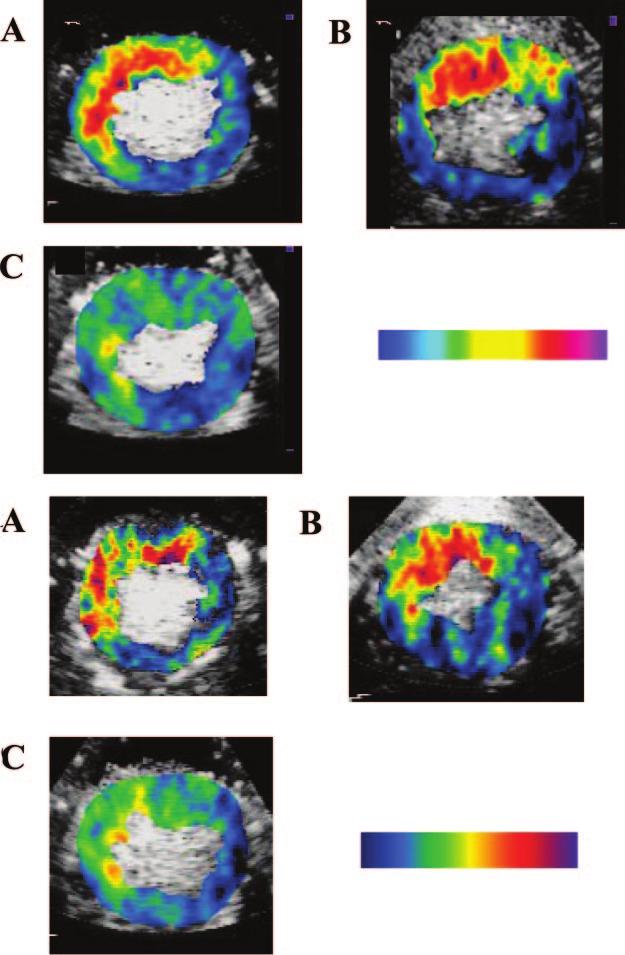 Kaul 25 Years of Myocardial Contrast Echocardiography 303 Figure 11. Top, Myocardial v 3 activity measured with the use of backscatter from echistatin-conjugated microbubbles.