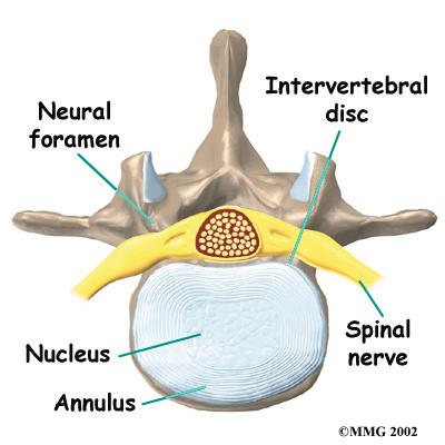 Surgeons perform lumbar discectomy surgery through an incision in the low back. This area is known as the posterior r region of the low back.