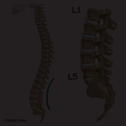 The Introduction Lumbar discectomy is a surgical procedure to remove part of a problem disc in the low back. The discs are the pads that separate the vertebrae.