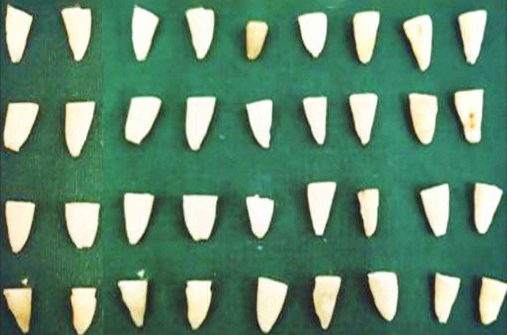 MATERIALS AND METHODS The study was done on 44 single-rooted extracted premolars with the following criteria: Inclusion Criteria Single-rooted premolar teeth. Teeth with no gross caries.