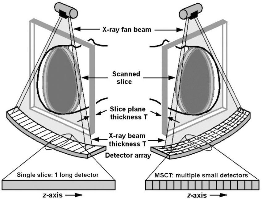 Reproduced from DJ Brenner, Computed Tomography An Increasing Source of Radiation Exposure (4) with permission from the Massachusetts Medical Society. Figure 2-4.
