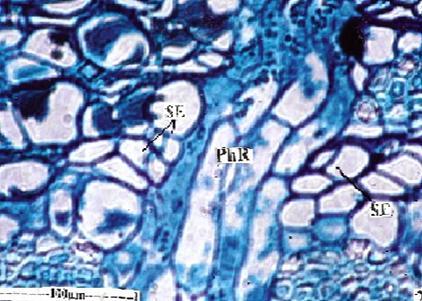 Microscopical study: Periderm: The periderm is superficial and undulate with deep folding and irregular thick endings. The periderm is 150-200µm thick.