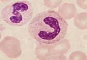 Macrophage Sentinel Cell Neutrophil