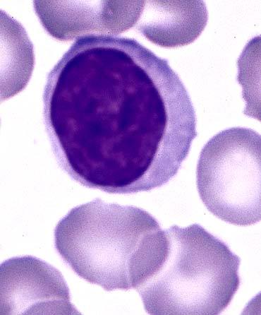 Lymphocytes Small lymphocyte large