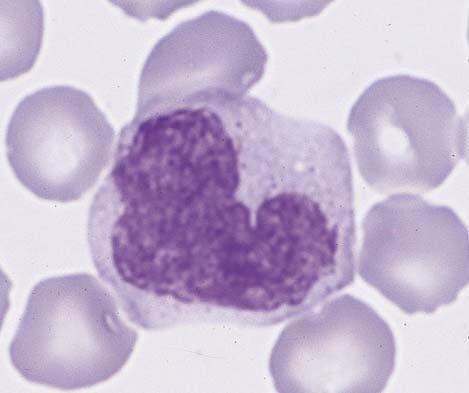 Monocytes This cell has an eccentric kidney-shaped nucleus with delicately