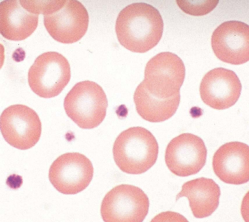 Platelets granulomere Hyalomere