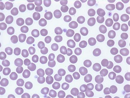 Red Blood Cells The appearance of normal circulating blood is relatively uniform with little variation in size and shape.