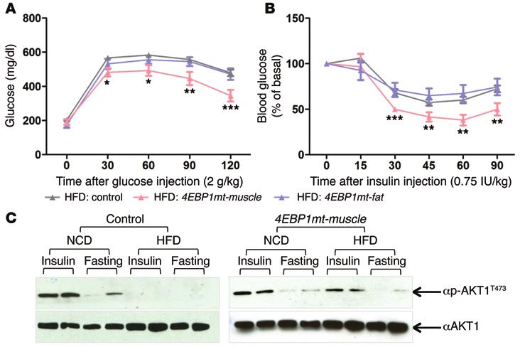 Figure 3. Tg-4EBP1mt-muscle mice preserve insulin sensitivity in HFD-induced type 2 diabetes mouse model.