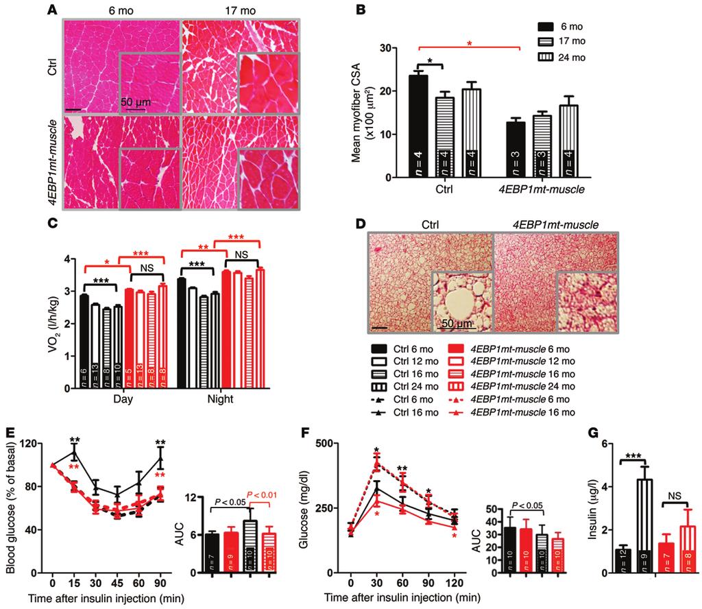 Figure 5. Activation of 4E-BP1 in mouse skeletal muscle protects mice from age-related metabolic decline.