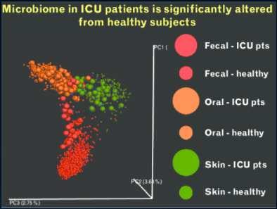 Loss of a Diverse Microbiome in the Critically Ill Microbiota Disruption in PICU Patients Gut Skin Tongue