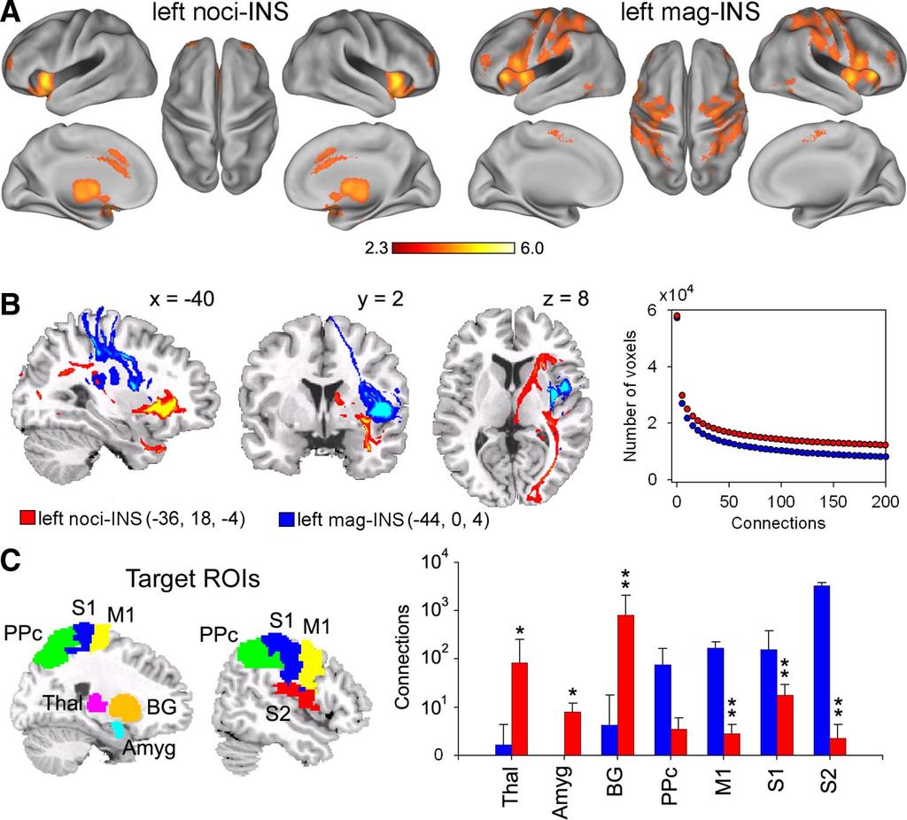 884 M. N. BALIKI, P. Y. GEHA, AND A. V. APKARIAN FIG. 6. Functional and anatomical dissociation in the insula. A: functional connectivity maps for left noci-ins and mag-ins.