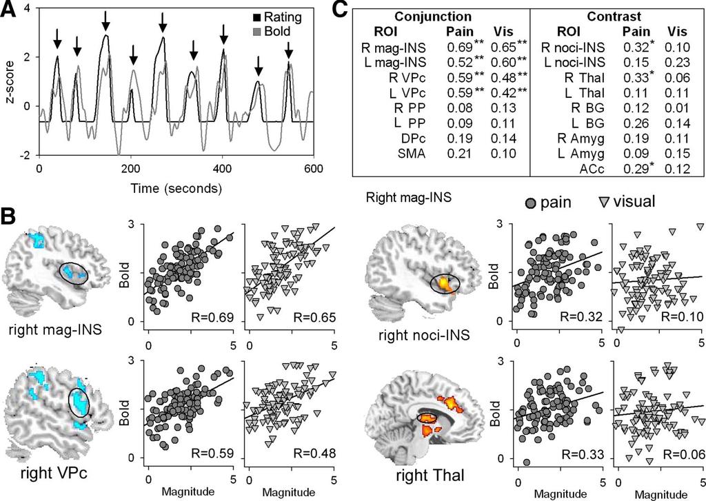 880 M. N. BALIKI, P. Y. GEHA, AND A. V. APKARIAN FIG. 4. Brain regions encoding magnitude for visual and pain perceived magnitudes.