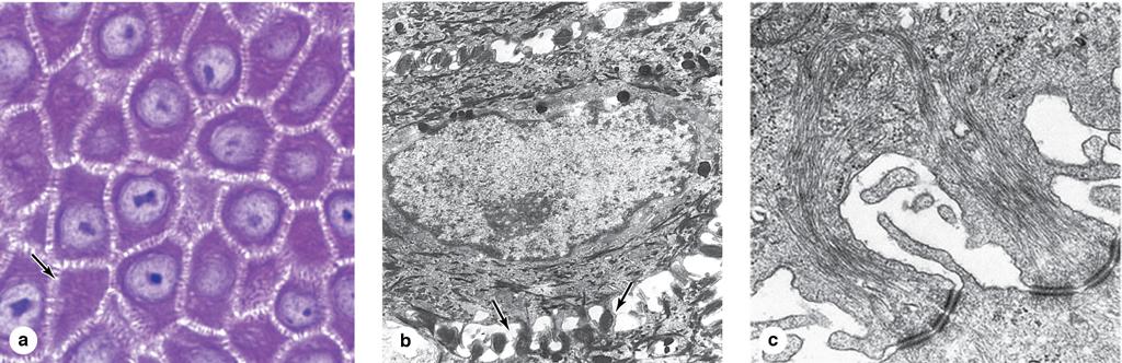 Cytokeratin filaments Spot