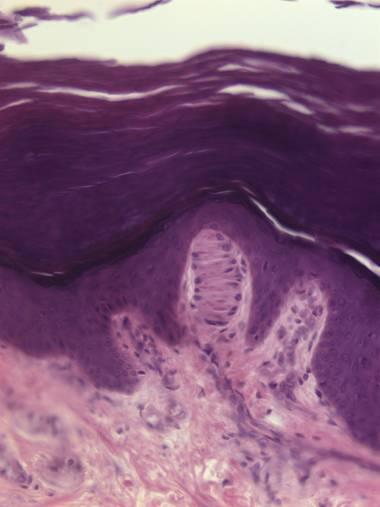 Meissner s corpuscle: