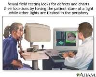 Detection Central vision Peripheral vision Serial ocular pressure monitoring (21 mm Hg) Serial
