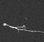Fig. 5 Morphology of the living neuron expressing GFP in a slice preparation.