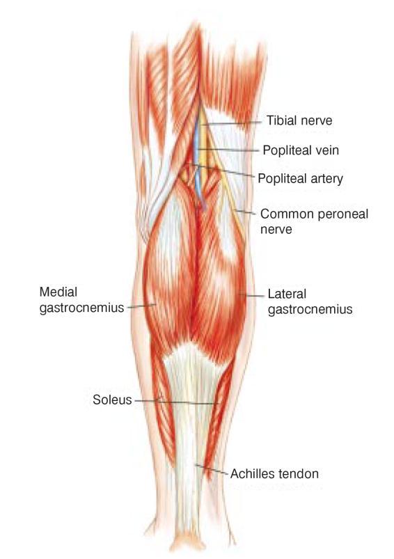 OnPulse TM Mechanisms of Action Electrode pair Gently stimulate the common peroneal