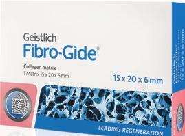 42 Fax +4 4 42 6 3 www.geistlich-biomaterials.com Product availability may vary from country to country.